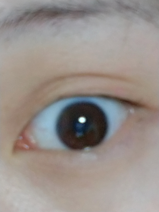 中学生です 顔のたるみってどうやったら治せるか分かりますか ちゃんと毎 Yahoo 知恵袋