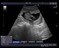 初めまして 16週2日の妊婦です 性別はまだわからないとの事ですが Yahoo 知恵袋