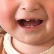 赤ちゃんの前歯は上下 二本づつ同時に生えるものですか 七ヶ月の赤ちゃんが Yahoo 知恵袋