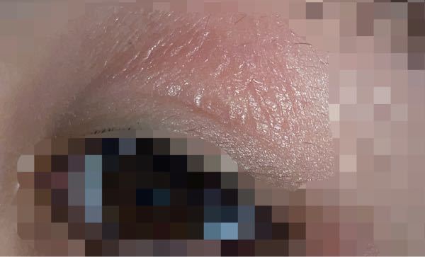 左瞼がこんな風にカサカサ してます 病院ではプレドニン眼軟膏を処方されたの Yahoo 知恵袋