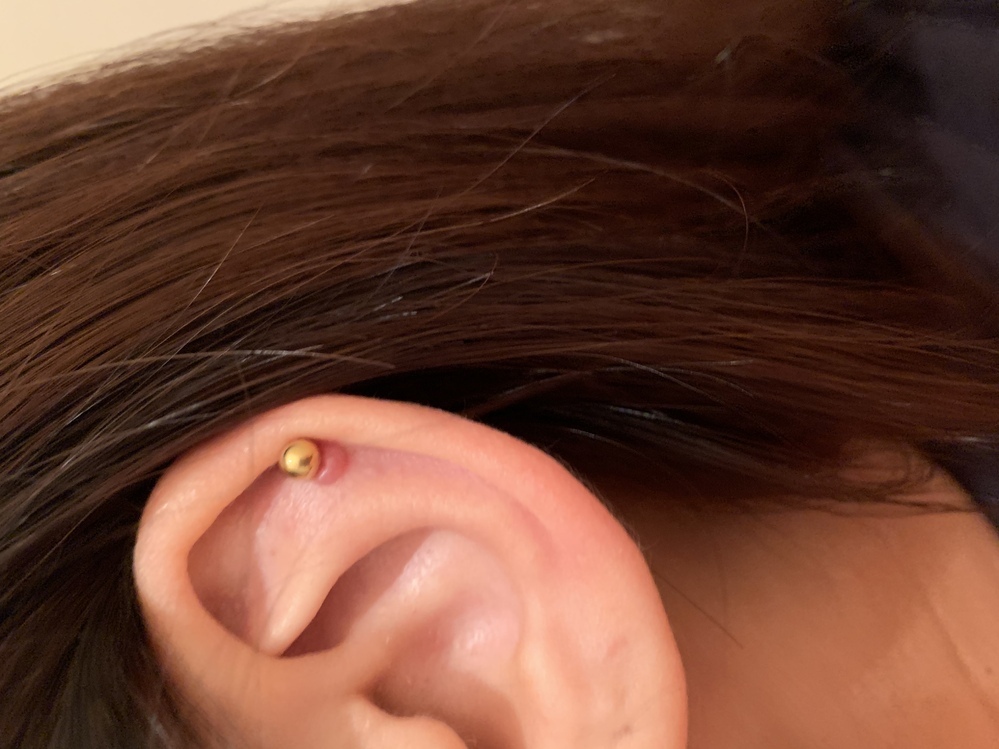 ピアスをあけて3ヶ月経過しました ずっとファーストピアスをつ Yahoo 知恵袋
