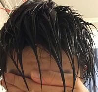 髪が濡れた際にとても髪が薄く見えるのですが ハゲてますかね 普通ですか Yahoo Beauty
