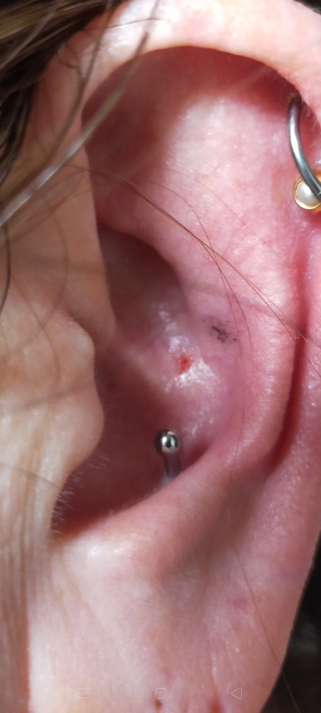 ピアスをあけて3ヶ月経過しました ずっとファーストピアスをつ Yahoo 知恵袋