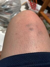 怒ると自分を殴ってしまう 21歳女性です 高校生頃から 怒ると自分 Yahoo 知恵袋