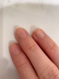 最近バイトを初めて 爪がボロボロになってしまいました 今までは爪を褒 Yahoo 知恵袋