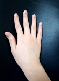 私の指は太いでしょうか いつもつける指輪のサイズは親指が1 Yahoo 知恵袋