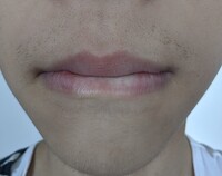 中3男子です 最近唇の上に硬めの髭が生えてきます 顎には産毛より少し濃いぐ Yahoo 知恵袋