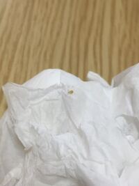 トイレットペーパーに付着している小さな虫は ダニ ですか 会社の女子達と話題に Yahoo 知恵袋