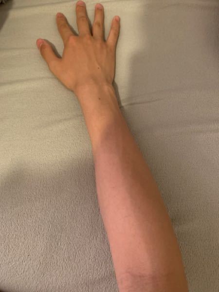 高2男子です。 - 最近腕が細いのがコンプレックスになってしまい