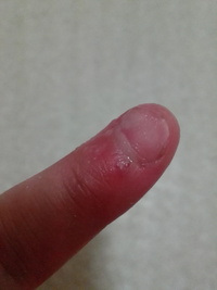 膣内に指を入れたら 白い膜の様なものが出てきました 生理など始まっておりま Yahoo 知恵袋