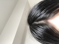 今年の1月ぐらいから 前髪の分け目部分が薄くなっていて 写真では Yahoo 知恵袋