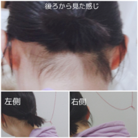 ショートから髪を伸ばして結べるようにしたいのですが 後ろの短い髪が出てしまい Yahoo 知恵袋