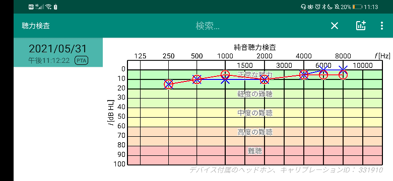耳の病気 投票受付中の質問 Yahoo 知恵袋