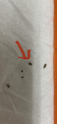 これはダニですか ノミ シラミ 犬のブラッシングの後に着いたのかもしれません 教えて 住まいの先生 Yahoo 不動産