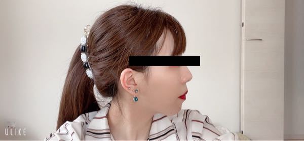 ブサイクな写真で申し訳ありません 現在 歯列矯正中です 元々口ゴボ気 Yahoo 知恵袋