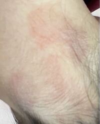 閲覧注意 首の後ろ うなじ部分 が触ってみて凄く乾燥して Yahoo 知恵袋