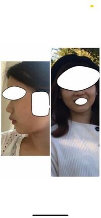 夢みる太陽をもし実写化するとしたら大家さん しま奈 善 朝陽さん 三浦 Yahoo 知恵袋
