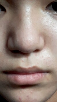足の親指のしびれについて質問します 両足の親指が一部だけしびれ Yahoo 知恵袋