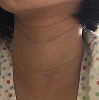 首の黒い線を消したい 中学生です 写真のような首の黒い線 を Yahoo 知恵袋