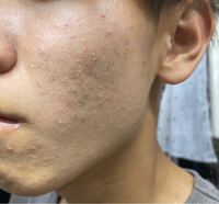 Bbクリームを塗ると粉吹きます。 - 男です。化粧水ジェルでスキンケアし... - Yahoo!知恵袋