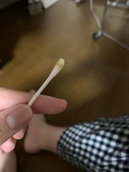 耳の病気 解決済みの質問 Yahoo 知恵袋