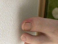 男性に質問 足のマニキュアは何色が好きですか 足の爪を強打して 血豆ができてし Yahoo 知恵袋