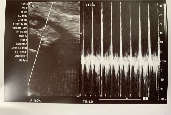 このエコー写真は何の情報を読み取るために渡されたのでしょうか Yahoo 知恵袋