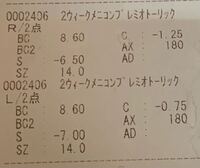 カラコンを買いたいのですが 乱視用があまりなくて 普通用で代用したい Yahoo 知恵袋