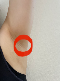 脇の下の あたりが少し痛みがあります 張ってるような感じで押すと痛みがとい Yahoo 知恵袋