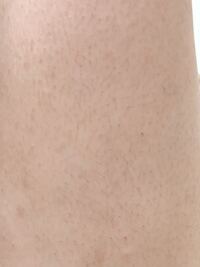 中３女子です 画像は太ももなんですがこれって毛深い方ですか 短パンを Yahoo 知恵袋