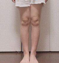 めちゃくちゃ細い子って 骨からして違いますよね 骨が太い子って Yahoo 知恵袋