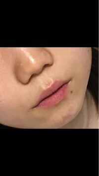 これ鼻低いですよね 男性はこんな鼻の人と付き合えますか Yahoo 知恵袋