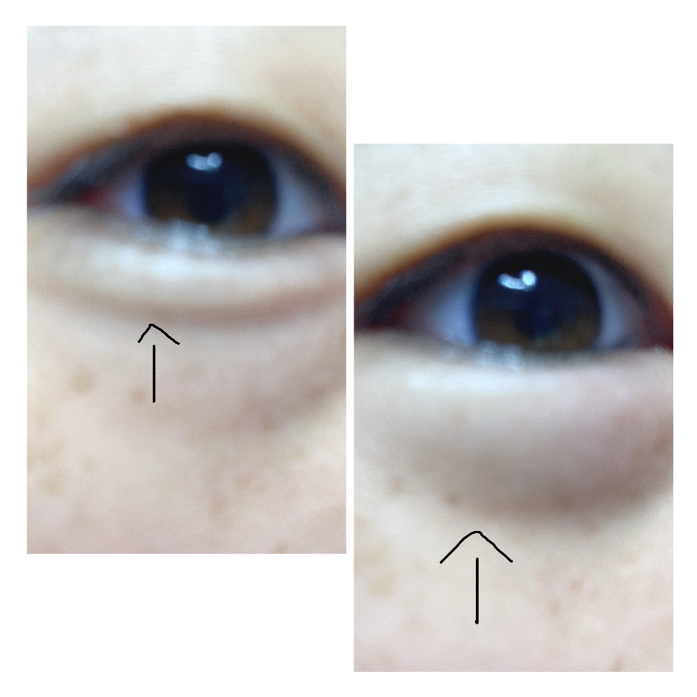 写真映りが悪いのはどうして 卒アルとかで生徒の顔一人づつ写真 Yahoo 知恵袋