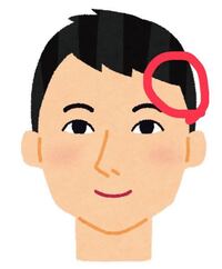 前から髪の毛のこの辺が少し引っ張ると抜けてここだけ髪質が少し違うんですけど Yahoo 知恵袋