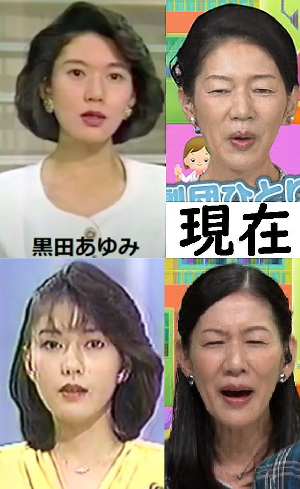 Nhkアナウンサー黒田あゆみの顔若い頃と比べ変わり過ぎじゃないですか Ht Yahoo 知恵袋