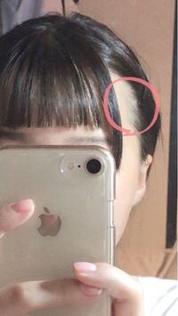 最近前髪の幅を狭くしたのですが 画像の通り印の部分が禿げてしまいます Yahoo Beauty
