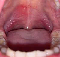 お見苦しい画像すみません 朝起きたら喉が痛くて写真を撮ってみた Yahoo 知恵袋