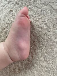 新生児 足の裏の膨らみについて もうすぐ１ヶ月になる子供の足の裏に左右 Yahoo 知恵袋