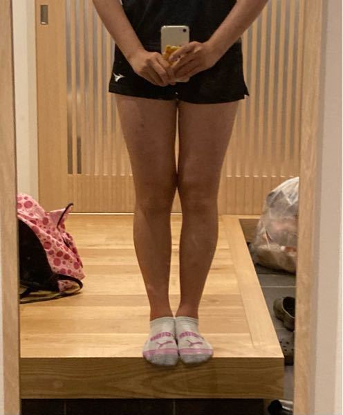 足太いですか この足でミニスカートとか履いたら変ですか 背 Yahoo 知恵袋