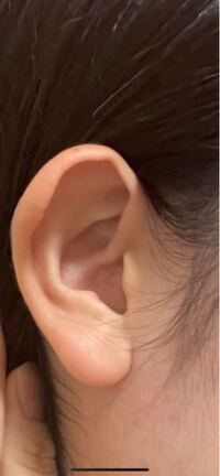 ピアスを開けたいのですが 正面から見た時耳が少し前のめり気味です Yahoo 知恵袋