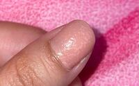 ネイルに気泡みたいなのが入ってしまいます 対処法ありますか Yahoo 知恵袋