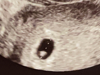 生理予定日から数えて5w6dで初診に行ってきました 胎嚢の確認は Yahoo 知恵袋