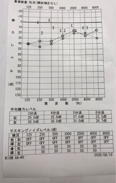 耳の病気 解決済みの質問 Yahoo 知恵袋