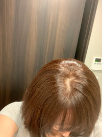 助けてください T T 自分で白髪染めをしたら失敗してしまいました 赤茶色 Yahoo 知恵袋