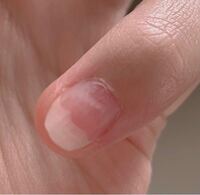 ネイルベッドについてです 少し前までネイルベッドを伸ばすためにジェル Yahoo 知恵袋