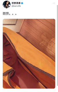 狩野英孝って 汗のアレルギーあるのにサウナ入ってるんですけど 大丈夫なんで Yahoo 知恵袋