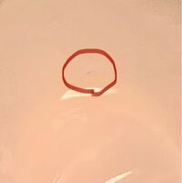 朝ごはんに卵を食べようとして殻を割った後に内側見たらひび 傷 が Yahoo 知恵袋