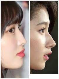 Twiceのメンバー よく美容整形チャンネルなどで理想の顔として Yahoo 知恵袋