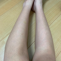 脚が透明感がなく、まだら模様な感じがずっと治りません。
日焼けでこのようになってしまったと思うのですが、日焼け止めを塗っても治りません。 どうしたら、色が白く綺麗な脚になれますか。教えてください。

※写真、本当に汚い脚です。すみません。