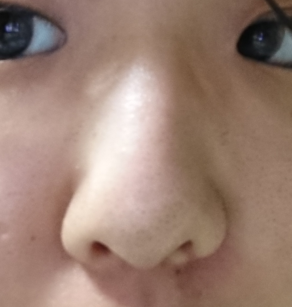 これって鼻中隔彎曲症でしょうか Yahoo 知恵袋